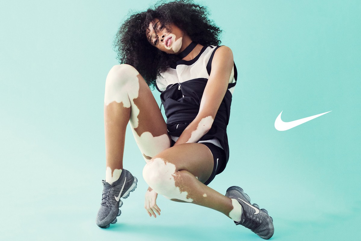 Woman with vitiligo poses in athletic wear and sneakers on a light teal background with the Nike logo visible in the frame.