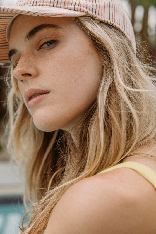 Close-up portrait of a young woman with blonde hair and freckles wearing a striped baseball cap in front of a blurred pool backdrop.