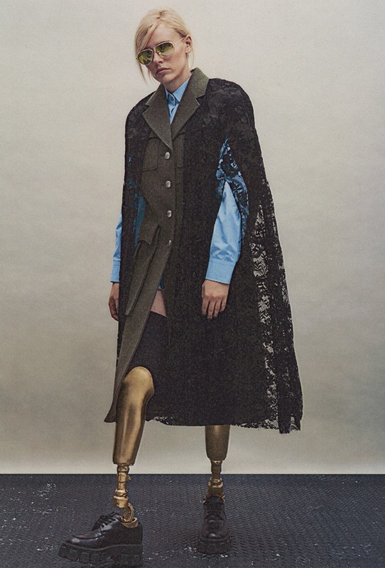 Fashionable woman in a lace cape, stylish top, and metallic prosthetic legs poses against a neutral background, showcasing unique style.