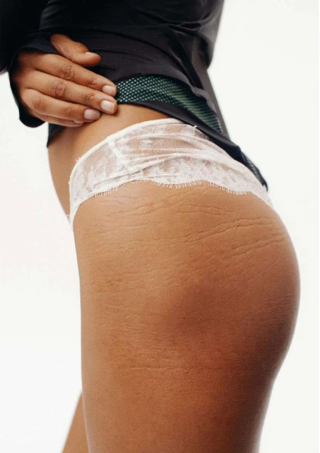 Close-up shot of a tan-skinned adult female's lower torso and upper thigh, wearing lace underwear, against a white backdrop.