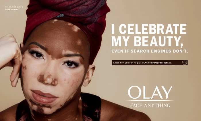 Close-up of woman with vitiligo wearing headscarf. Beige background with campaign text. Beauty and skincare advertising. Portrait orientation.