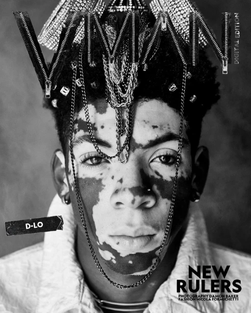 Striking black and white portrait of a person with vitiligo wearing a zipper crown and chain jewelry, evoking a modern, edgy fashion editorial.