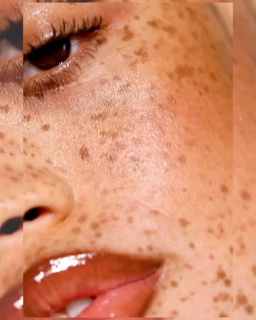 Extreme close-up portrait of a face with prominent freckles, dark glossy lips, and detailed eyelashes captured by Jenn Collins.