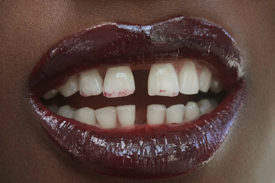 Close-up of an adult female's mouth with dark red lipstick and white teeth, highlighting beauty and dental care. Skin has dark complexion.