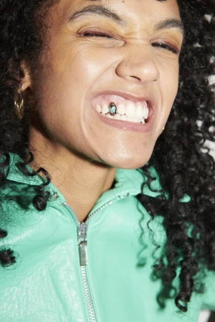 Close-up of an adult woman smiling, wearing a bright green jacket and a grill on her tooth, against a white background.
