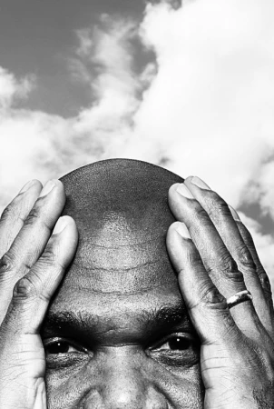 Close-up black and white portrait of a bald man holding his head with both hands against a cloudy sky