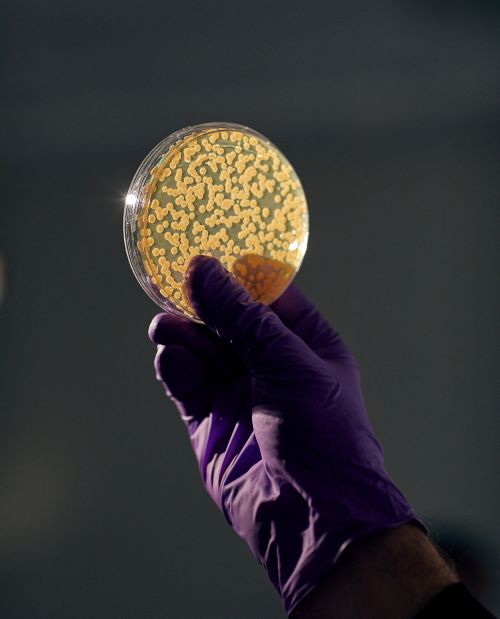 A gloved hand holds a petri dish filled with cultures or bacteria in a lab setting, illuminated by a bright, focused light source.