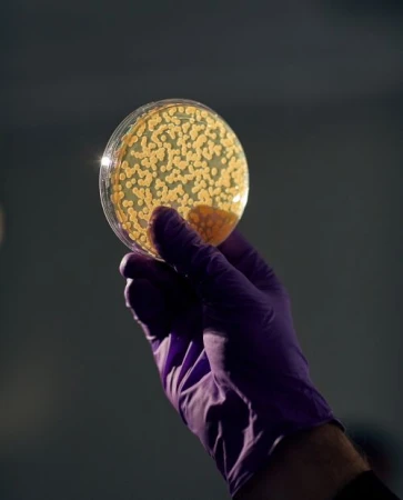 A gloved hand holds a petri dish filled with cultures or bacteria in a lab setting, illuminated by a bright, focused light source.