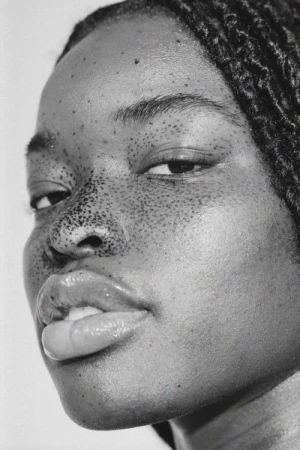 Monochrome close-up portrait of a Black woman with prominent freckles and braided hair by Ali Mitton.