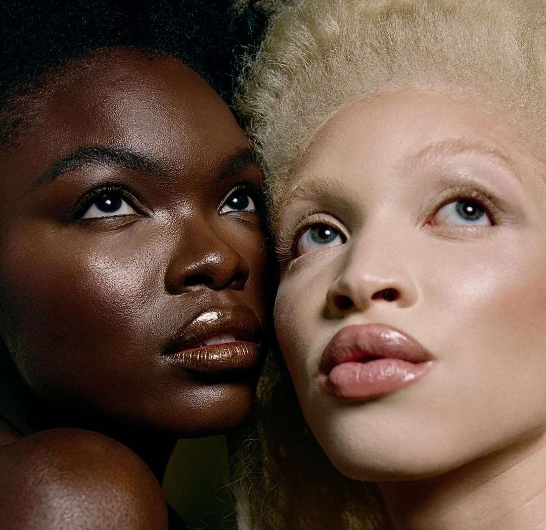 Close-up portrait of two women with distinct skin tones, one dark and one fair, showcasing glossy lips and upward gaze in a beauty style.