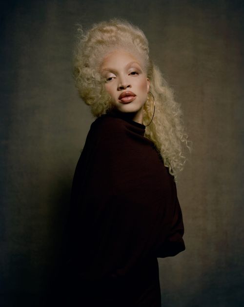Fashion portrait of an albino woman with curly hair, wearing a maroon dress and gold hoop earrings, posing against a neutral background.