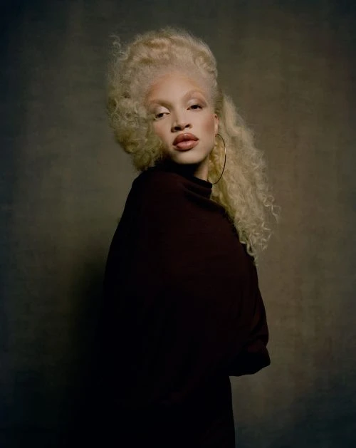 Fashion portrait of an albino woman with curly hair, wearing a maroon dress and gold hoop earrings, posing against a neutral background.