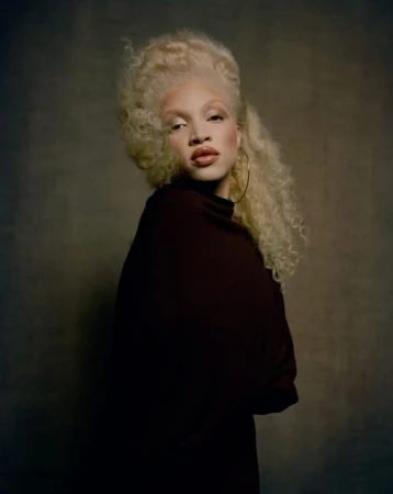 Fashion portrait of an albino woman with curly hair, wearing a maroon dress and gold hoop earrings, posing against a neutral background.