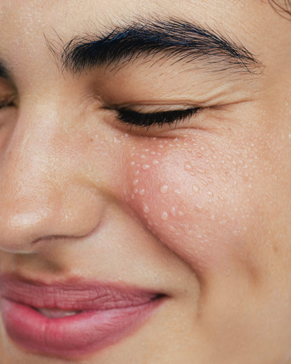 Extreme close-up portrait of a woman with dewy skin, visible droplets, and natural flushed cheeks by Irina Shestakova
