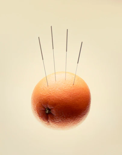 An orange fruit pierced with four acupuncture needles against a plain cream background by Olivia Giles.
