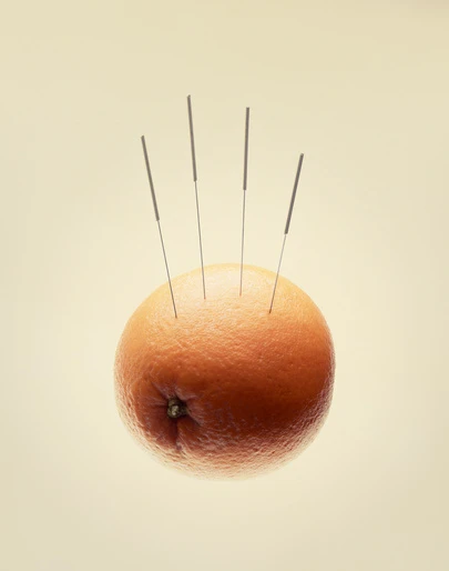 An orange is presented with acupuncture needles inserted, set against a pale background in a studio-like environment, conveying healthcare.