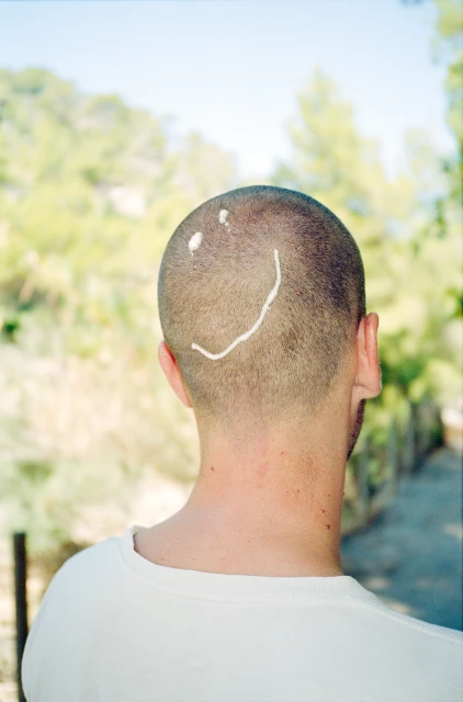 Adult male with a shaved head outdoors, featuring a smiley face drawn with sunscreen, with blurred green trees in the background.