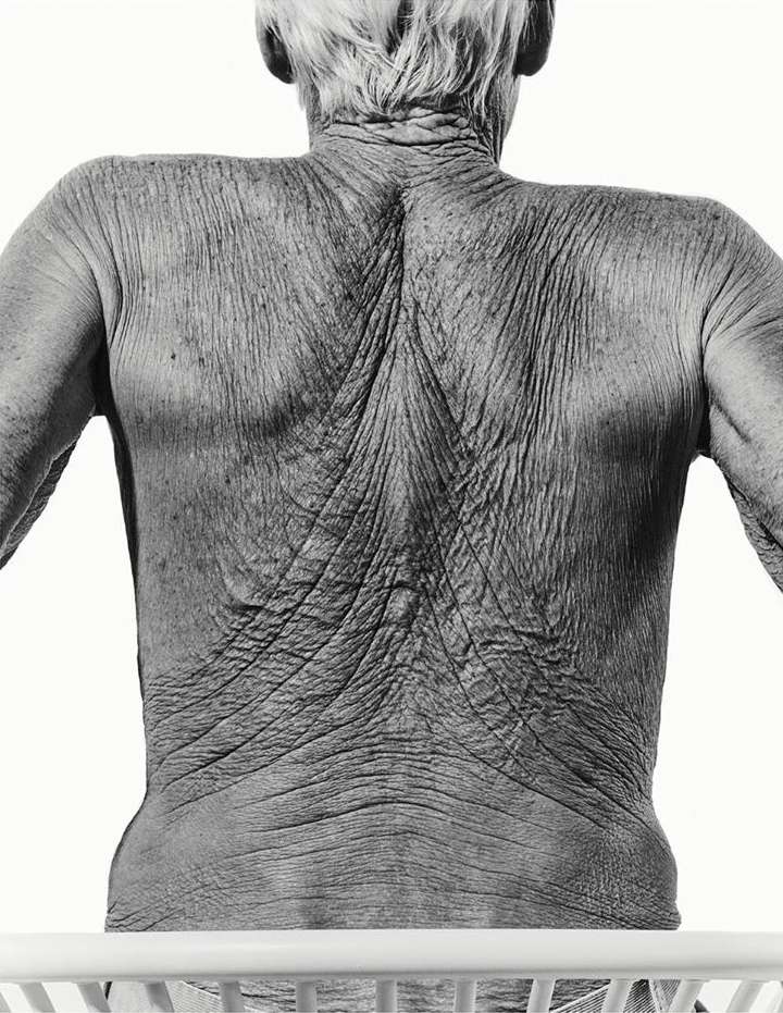 Monochrome close-up of an elderly person's wrinkled back and shoulders, showcasing skin texture against a bright background.