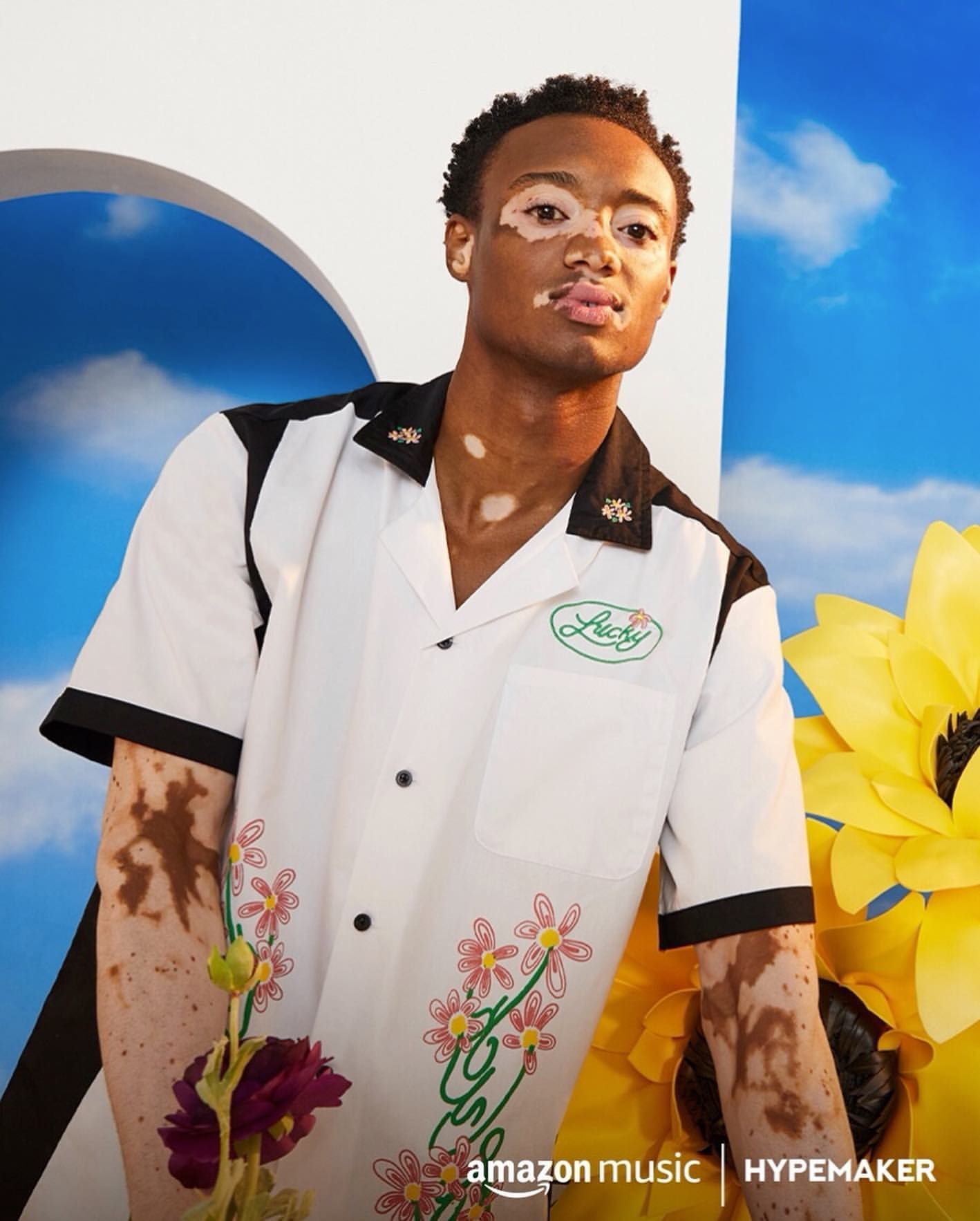 Stylish male model with vitiligo poses in white floral shirt with sunflower in a bright outdoor setting under a partly cloudy sky.