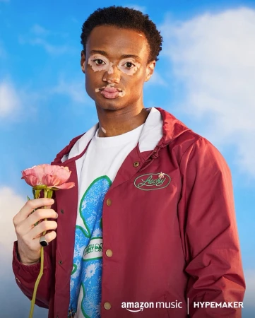 Portrait of adult male with vitiligo holding pink flower against a blue cloudy sky, wearing a maroon jacket and graphic tee. Amazon Music logo.