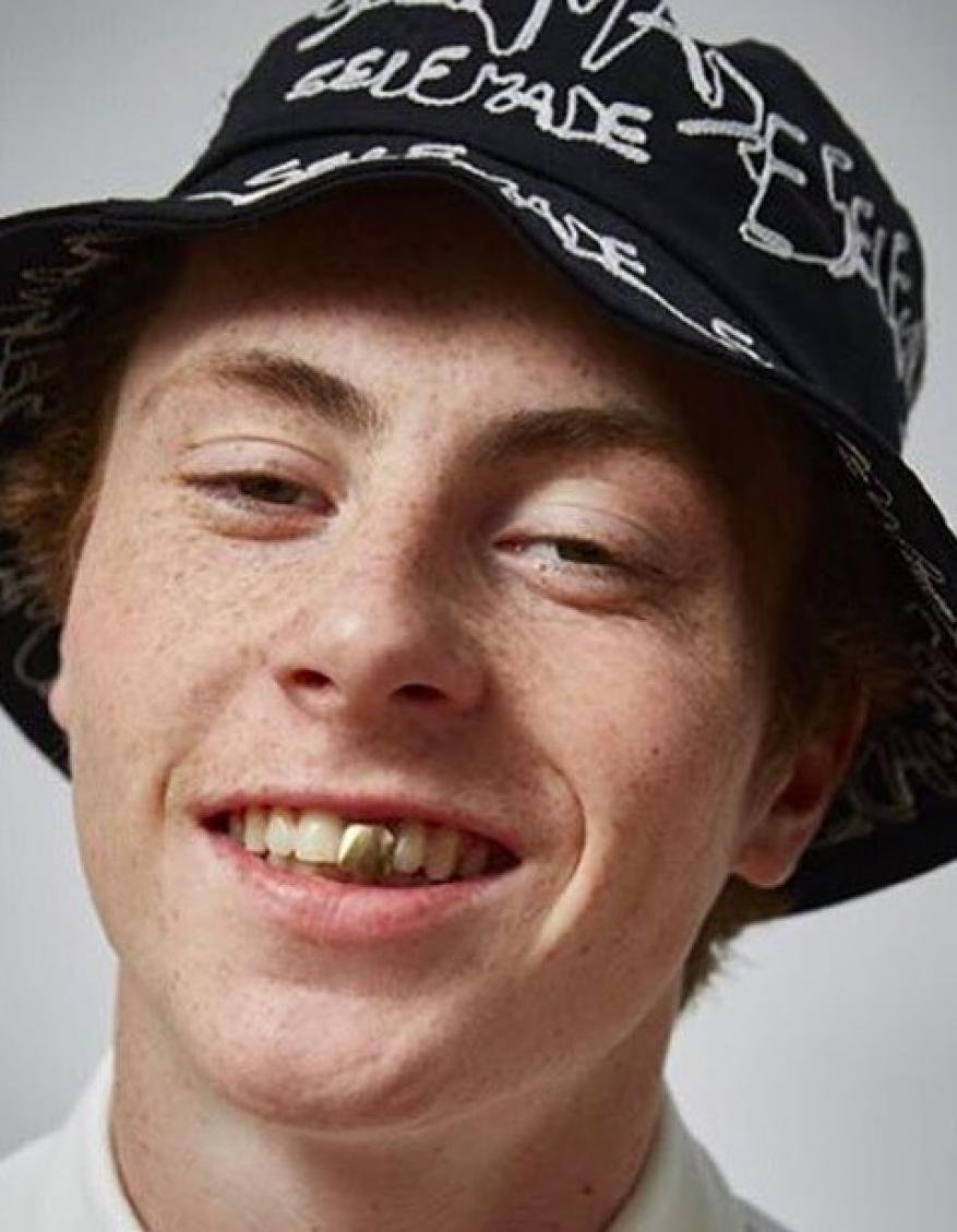 Close-up of a smiling adult male with a bucket hat. He has fair skin, freckles, and a gold tooth, facing forward in a studio setting.
