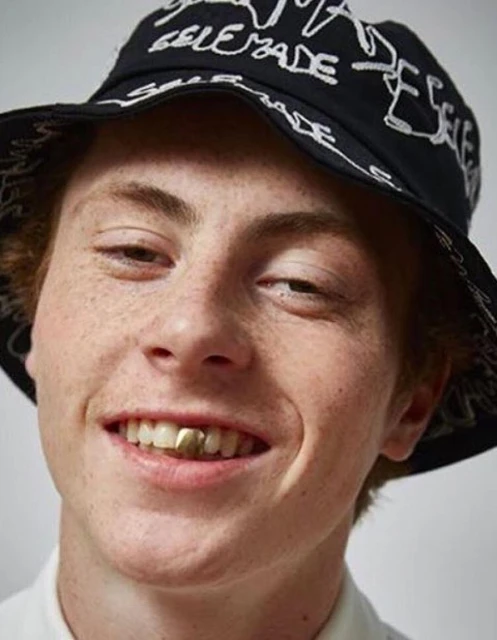 Close-up of a smiling adult male with a bucket hat. He has fair skin, freckles, and a gold tooth, facing forward in a studio setting.