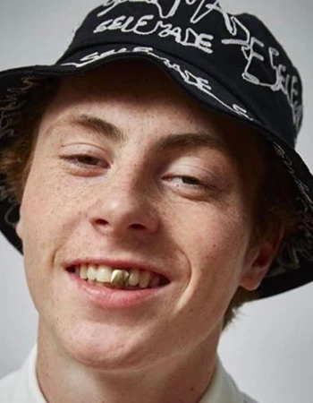 Close-up of a smiling adult male with a bucket hat. He has fair skin, freckles, and a gold tooth, facing forward in a studio setting.