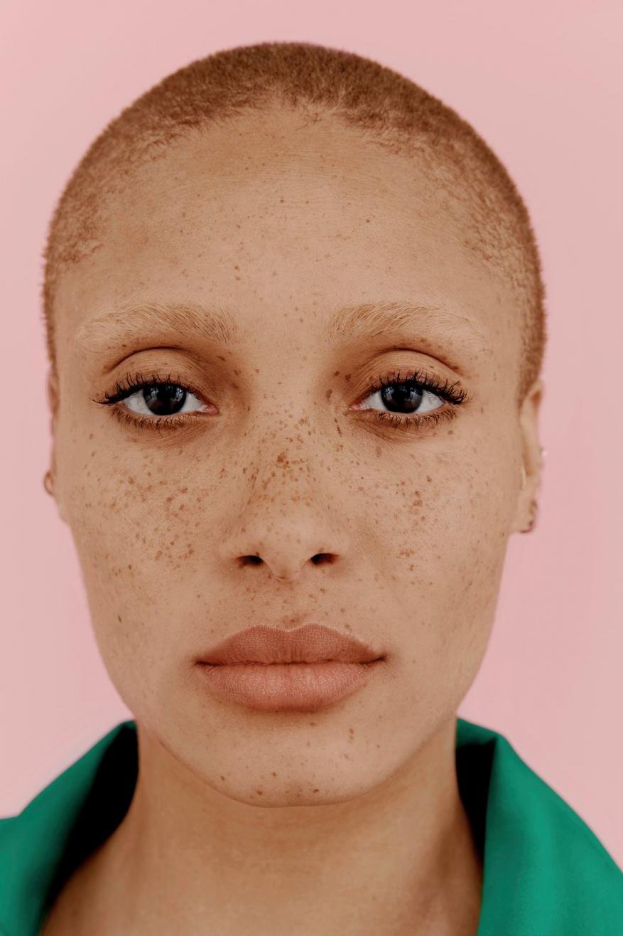 Close-up portrait of a person with short shaved brown hair, prominent freckles, and a green collar against a pink background
