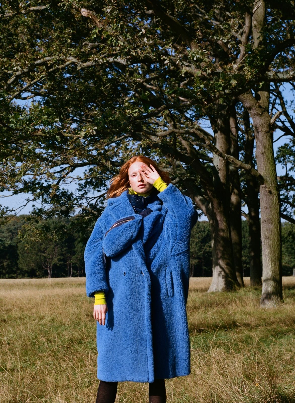 A red-haired woman in a blue coat and yellow turtleneck stands in a field under trees, covering her eye with her hand in a fashion pose.