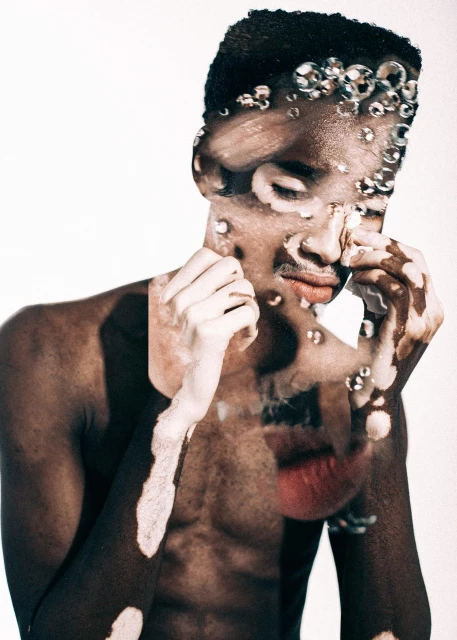 Striking portrait of a shirtless Black man with vitiligo, showcasing his unique skin and a water droplet overlay, against a white background.