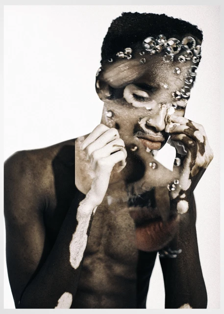 Portrait of a young adult male with vitiligo and water droplets on his face, captured in a studio setting with a white background.