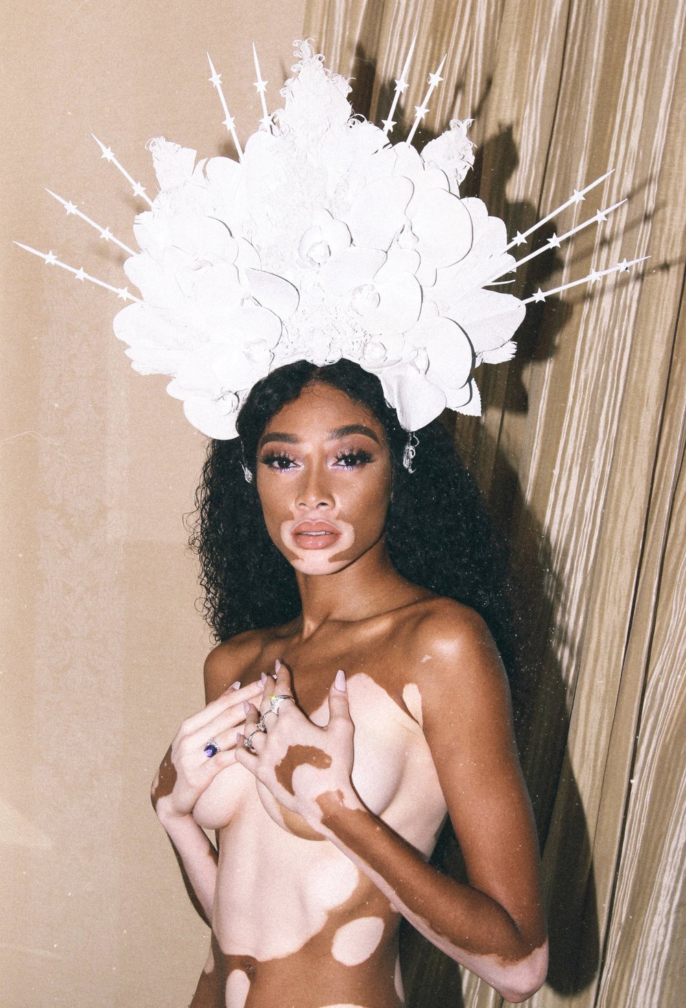 Striking studio portrait of an adult woman with vitiligo wearing a decorative headdress, posing nude against a neutral curtain background.