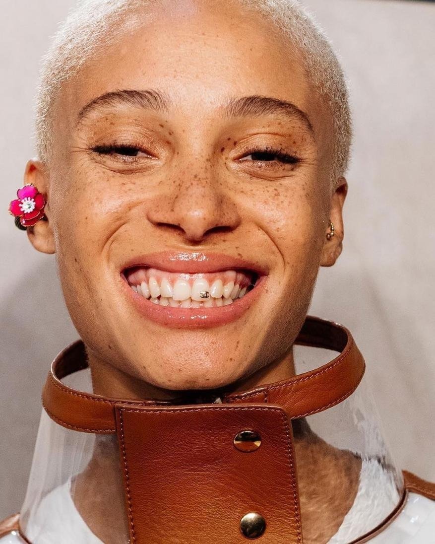 Close-up of a smiling person with light skin, freckles, and short, light-colored hair wearing a tan and clear jacket.