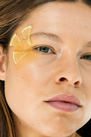 Close-up of a woman's face with three lemon wedges placed artfully on her forehead and cheek in a beauty or wellness context.