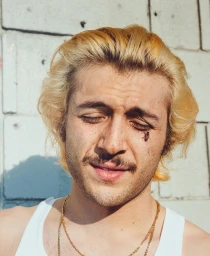 Close-up portrait of a young man with blonde hair and a bee resting near his closed eye, photographed by Abdi Ibrahim.