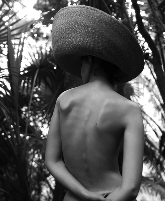 Black and white portrait of a woman with bare back and a large hat, facing away from the camera in an outdoor setting with leafy trees.
