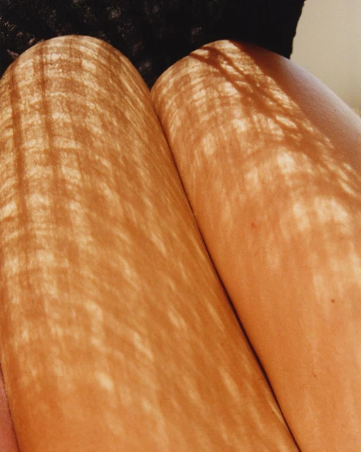 Close-up on a person's thighs with shadows creating a pattern, set against a dark lace material, suggesting an intimate setting.