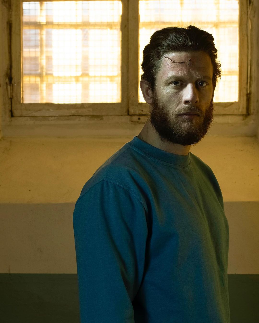 Portrait of a bearded man with a head wound, wearing a teal shirt, in front of a barred window with muted light and neutral colors.