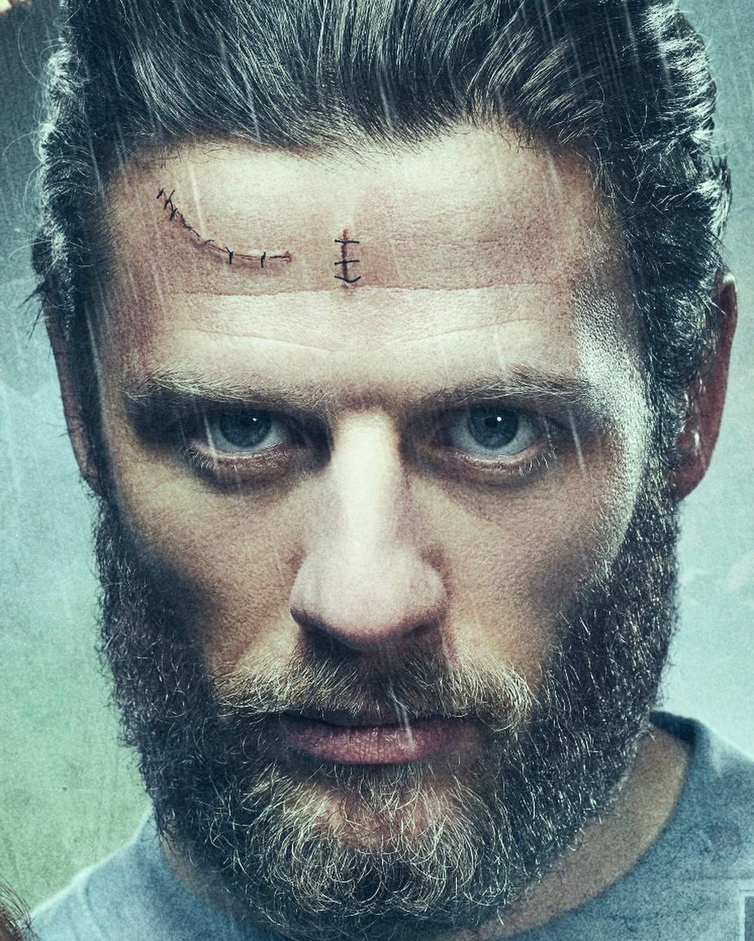 Close-up portrait of a bearded man with scars and stitches on his forehead, set against a blurred background, captured in wet conditions.