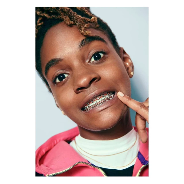 Close-up portrait of a young Black woman smiling and pointing to her teeth with braces, wearing a pink hoodie against a light grey background.