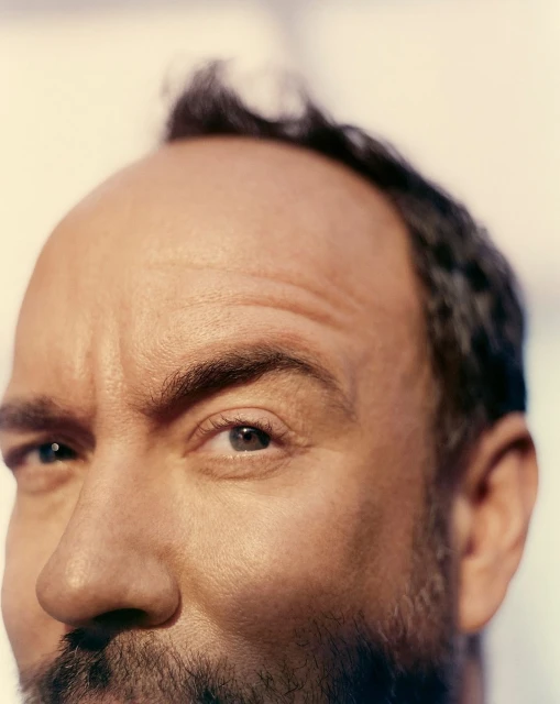 Close-up portrait of an adult male with a receding hairline, fair skin, and facial hair, set against a light background in a photo studio.