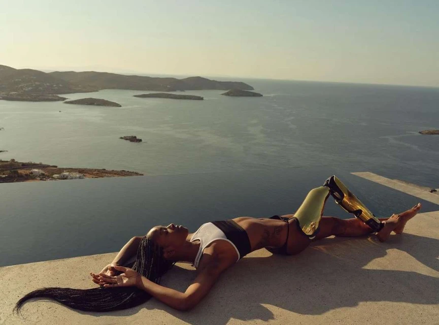 Woman with a prosthetic leg lounges on a concrete ledge overlooking the ocean, featuring distant islands and a clear horizon.