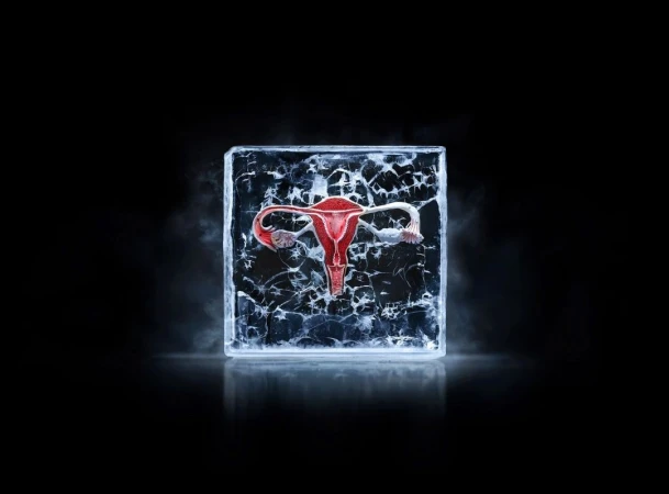 Uterus encased in cracked ice block on a black reflective surface with hazy vapor around the base and ice block, studio shot.
