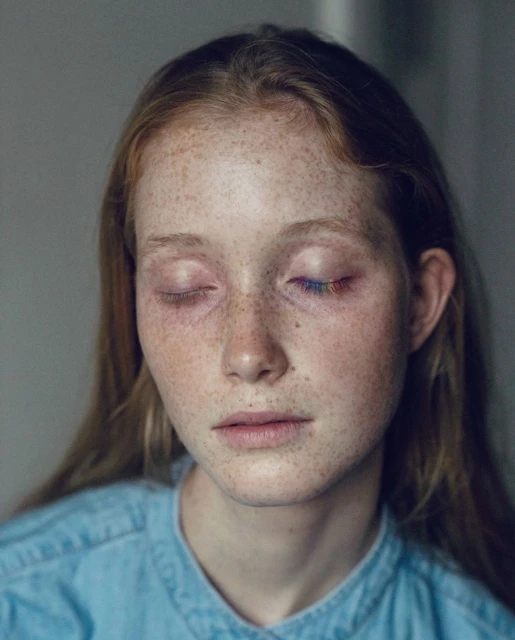 Portrait of a freckled young woman with closed eyes and colorful threads on one eyelid, wearing a denim shirt against a grey background.