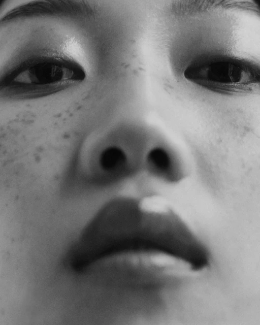 Close-up portrait of a person with visible freckles, focusing on the face including eyes, nose, and mouth in grayscale tones.