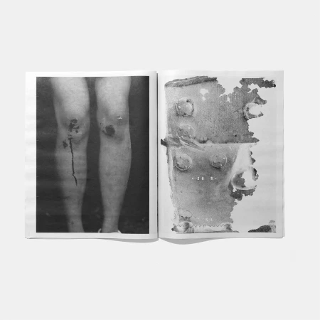 Monochrome image in an open book shows a person's injured knees and a textured metal plate on white paper, creating an abstract composition.