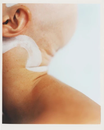 Close-up of a fair-skinned person's neck and upper shoulder with a white cream product applied, set against a pale background.