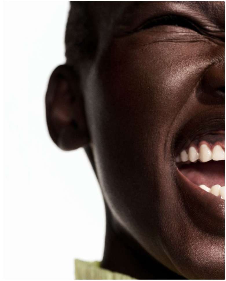 Extreme close-up of a dark-skinned woman's face with a wide smile, showcasing bright white teeth against a bright white background.