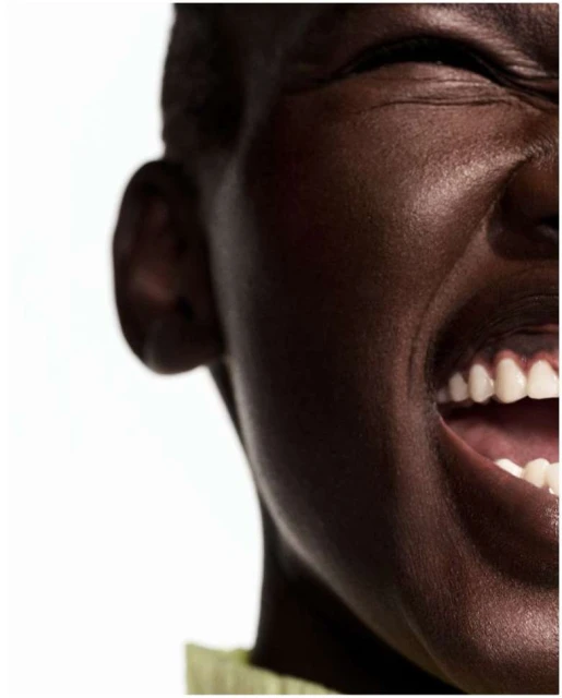 Extreme close-up of a dark-skinned woman's face with a wide smile, showcasing bright white teeth against a bright white background.