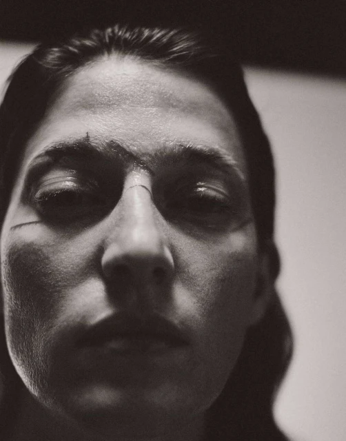 Close-up black and white portrait of a person with markings on their face looking directly at the camera with soft, diffused lighting.